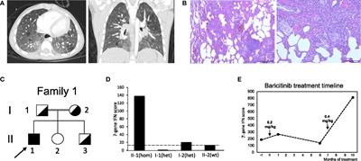 Phenotypic spectrum in recessive STING-associated vasculopathy with onset in infancy: Four novel cases and analysis of previously reported cases